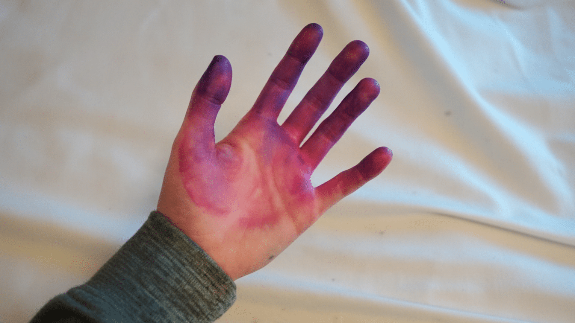 How to Get Hair Dye Off Skin?