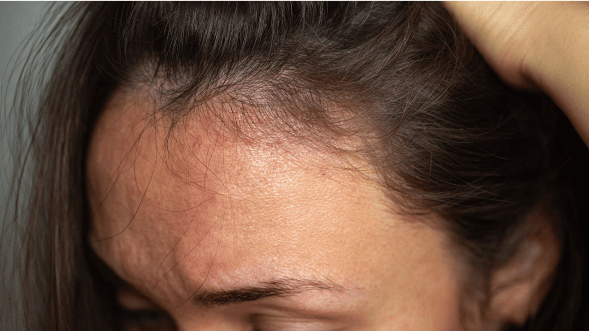 A person checking skin for redness itching or swelling after hair dye use with focus on early signs of irritation