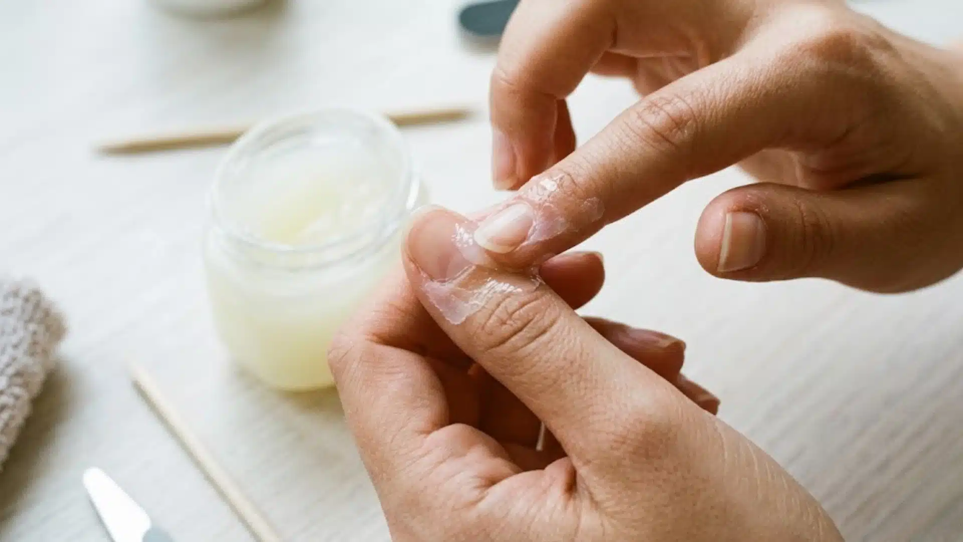 Applying petroleum jelly from a glass jar to the skin around a thumbnail