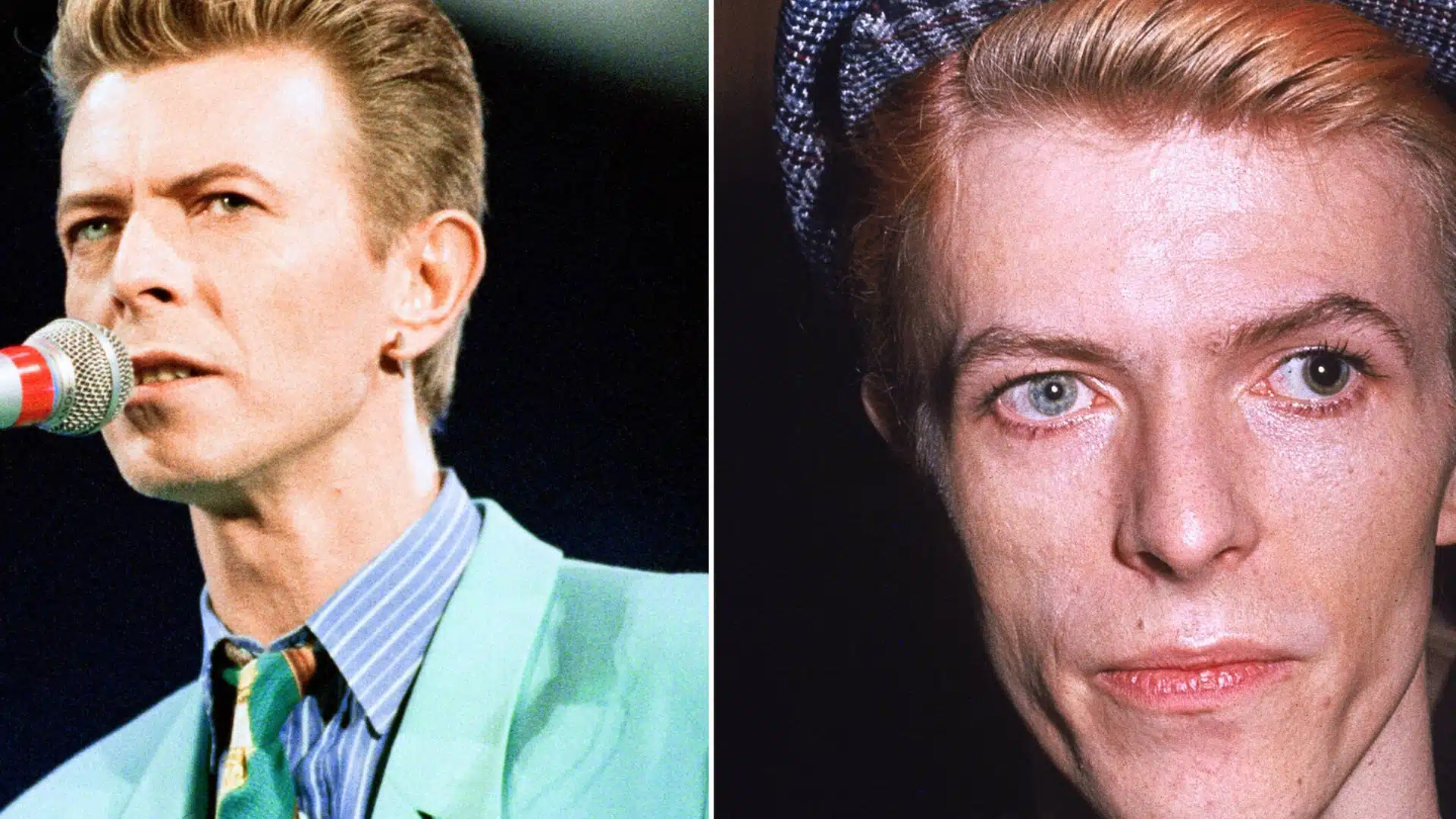 Side by side photos showing David Bowie's different colored eyes, with one pupil visibly larger than the other