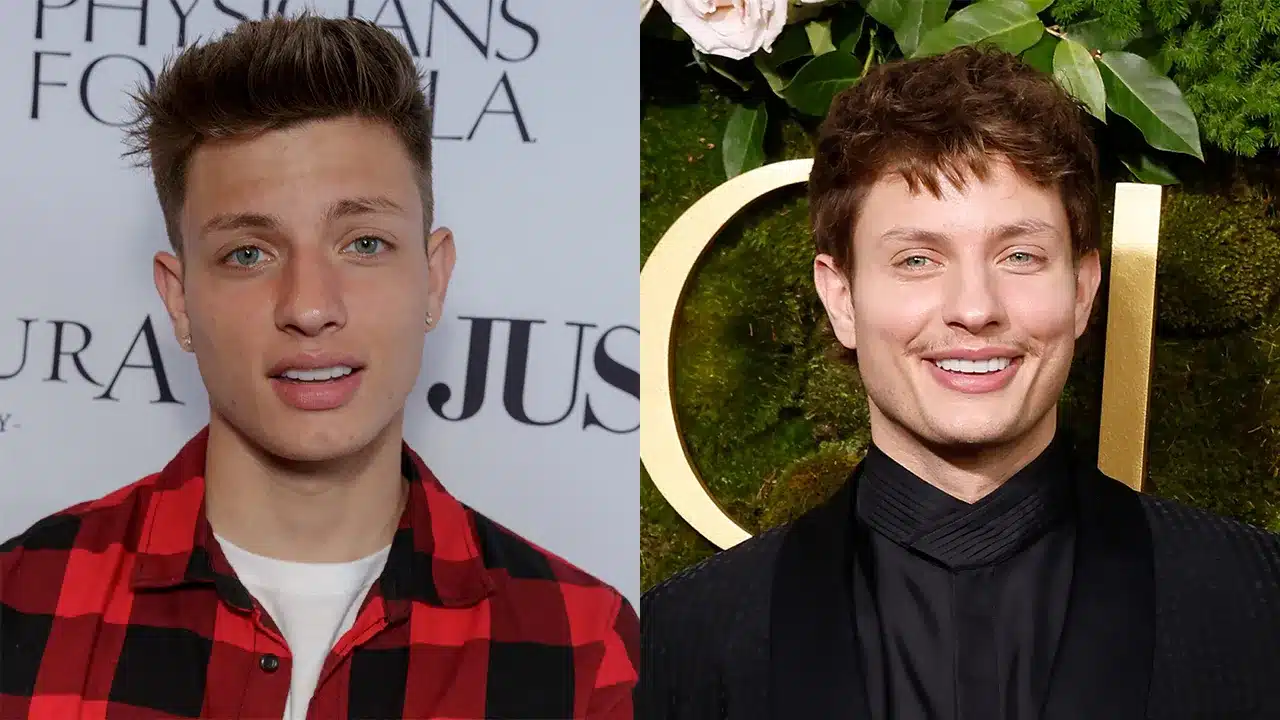 matt rife before and after surgery comparison