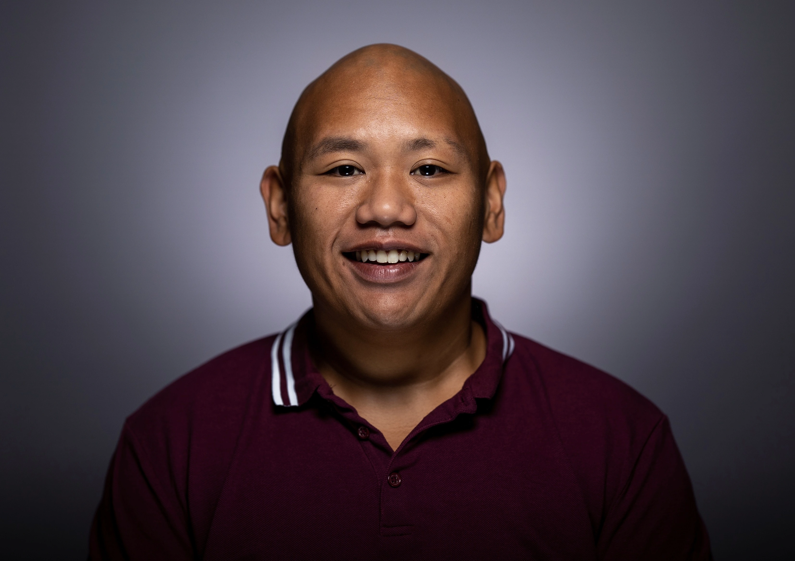 Jacob Batalon hair loss from alopecia, pictured with his natural bald appearance.