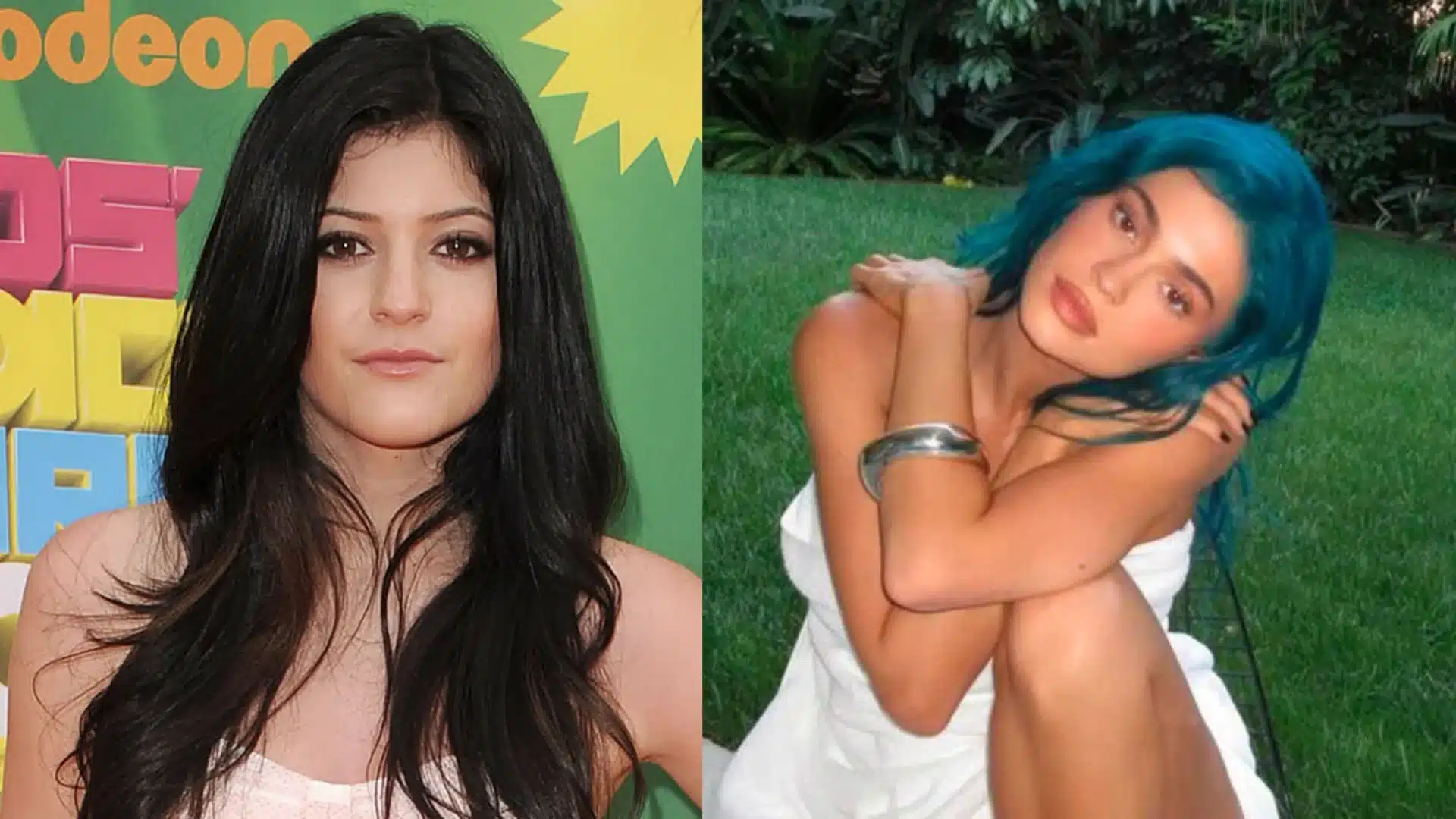Side-by-side comparison of Kylie Jenner, showcasing the effects of facial procedures on her appearance